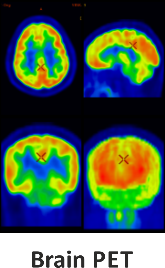 BRAIN PET
