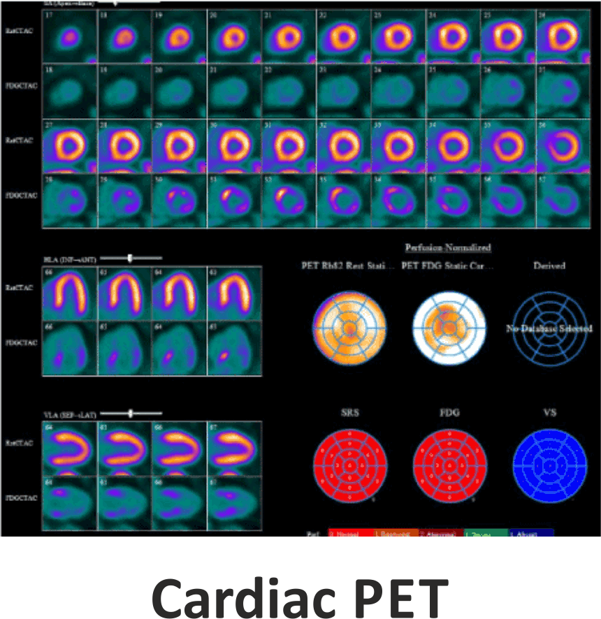 CARDIAC PET